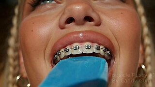 A I Popsicle Pussy 1 Cute College Coed With Braces